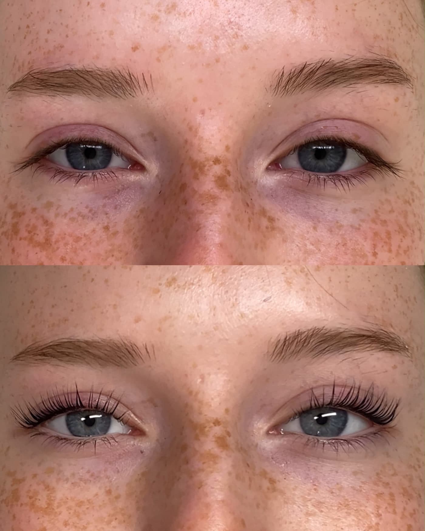 Wimpernkranzverdichtung: Vorher-Nachher-Vergleich