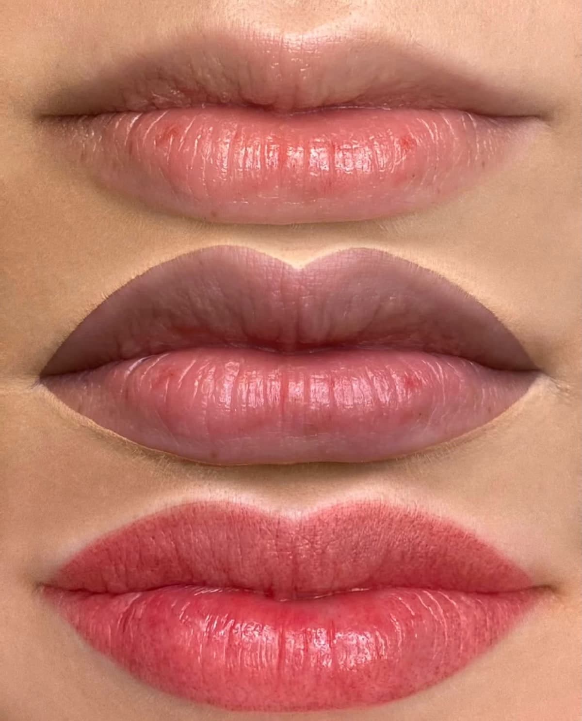 Lippenpigmentierung: Vorher, während des Abheilens und Endergebnis